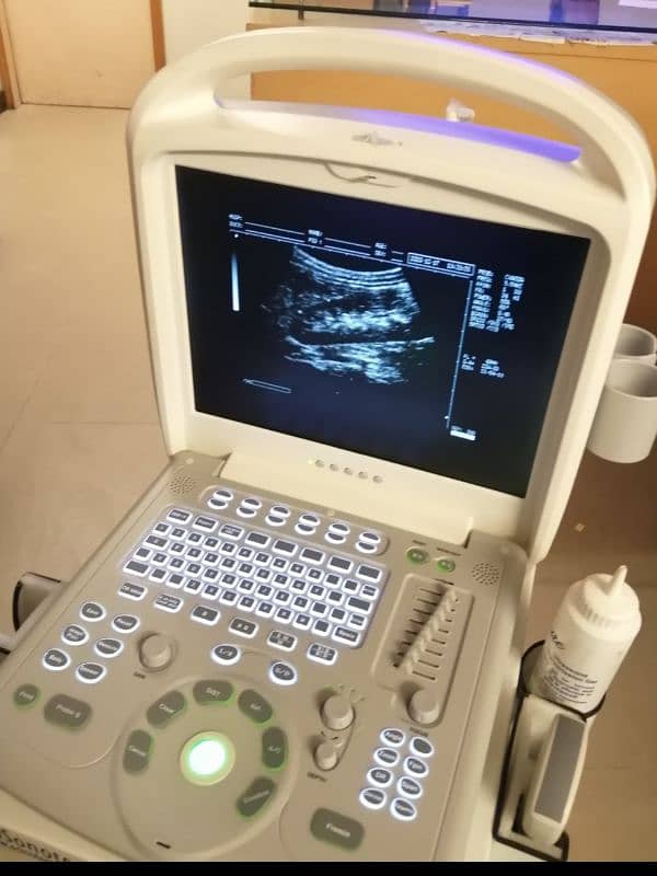 ultrasound machine,2025 model OXQT 880 full digital,ultrasound machine 2