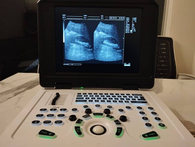 ULTRASOUND MACHINE / NOVADEX N12 DIGITAL NOTE BOOK / ULTRASOUND MCHINE 4