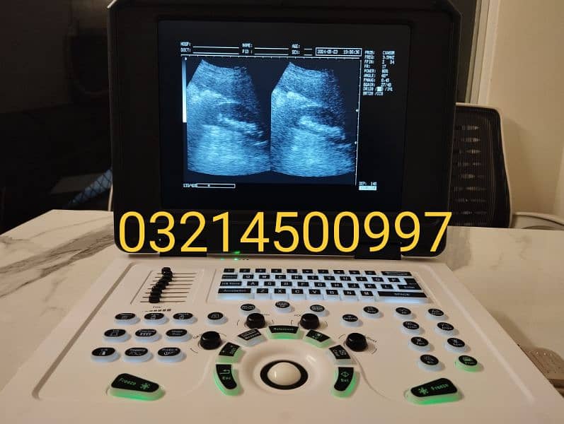 ULTRASOUND MACHINE / NOVADEX N12 DIGITAL NOTE BOOK / ULTRASOUND MCHINE 5