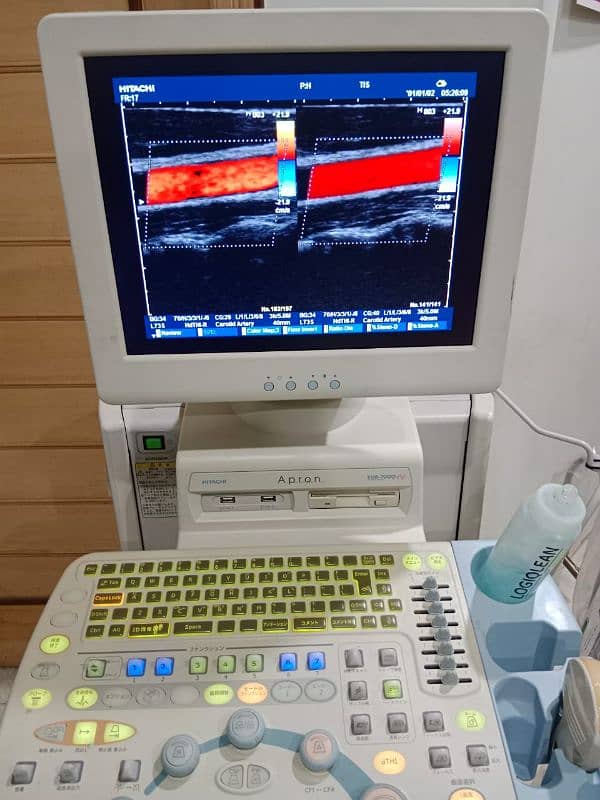 Hitachi EUB 7000 HV Ultrasound 1