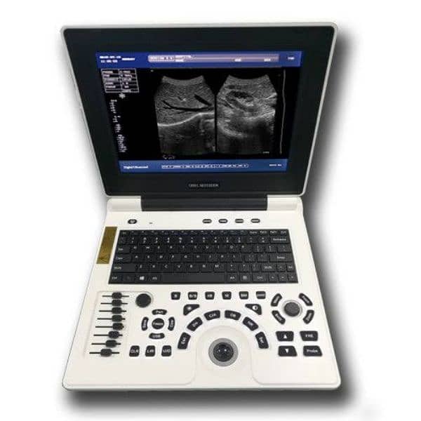 Ultrasound with convex probe brand new. 2