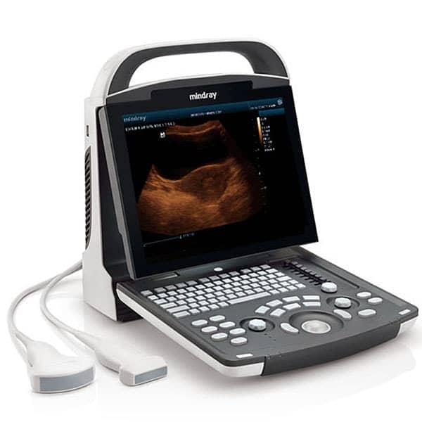 Ultrasound machine color doppler, grayscale new/refurb colour dopler 6