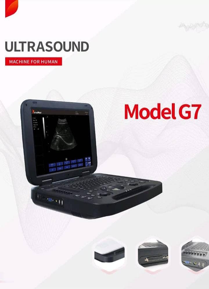 Ultrasound machine color doppler, grayscale new/refurb colour dopler 7