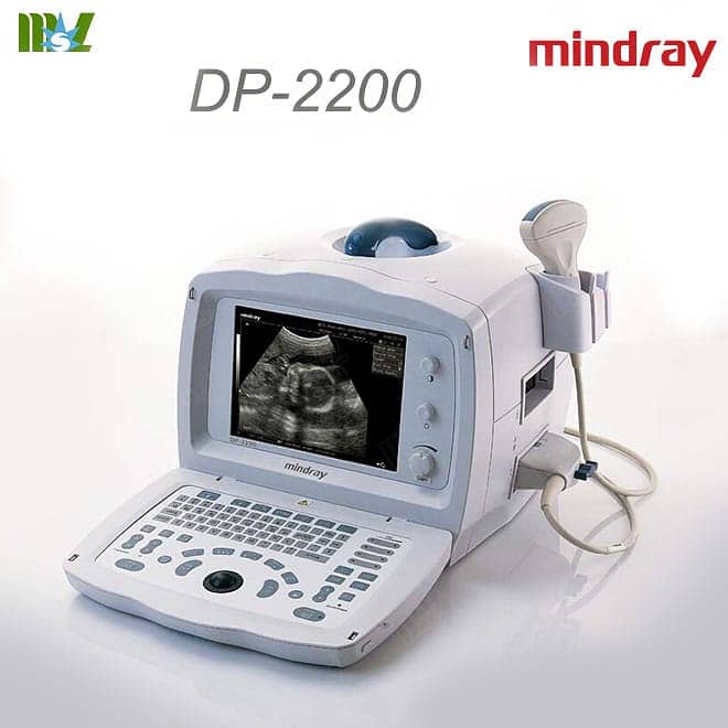 Ultrasound machine color doppler, grayscale new/refurb colour dopler 10