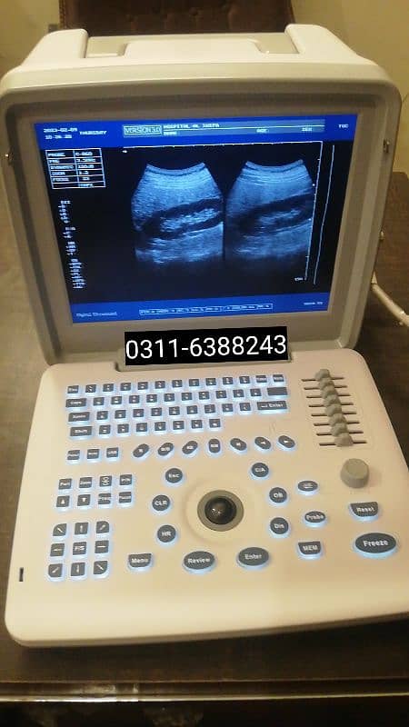 Branded Ultrasound Machine's 14