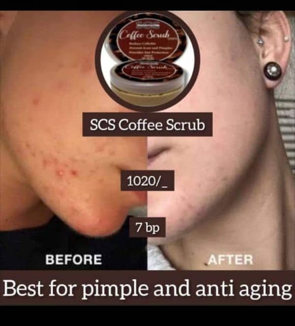 coffee scrub is best for Acne and sacrs herbal products 6