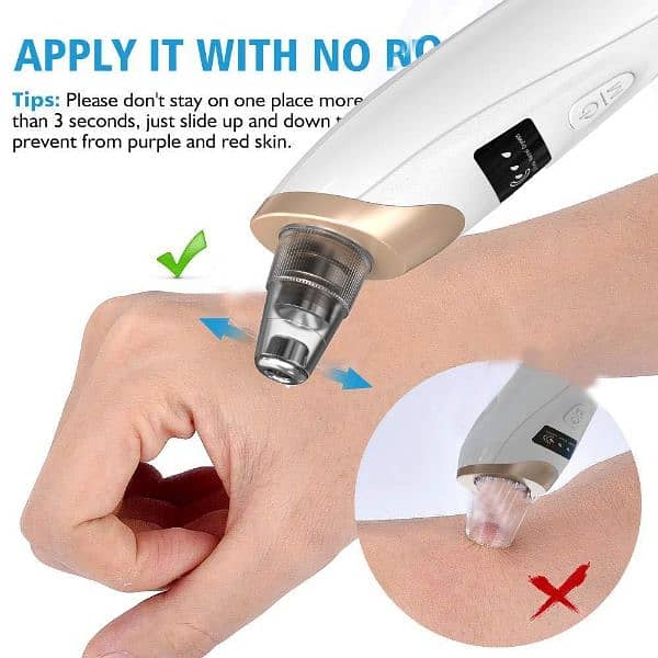 portable Blackhead pore clenar 1