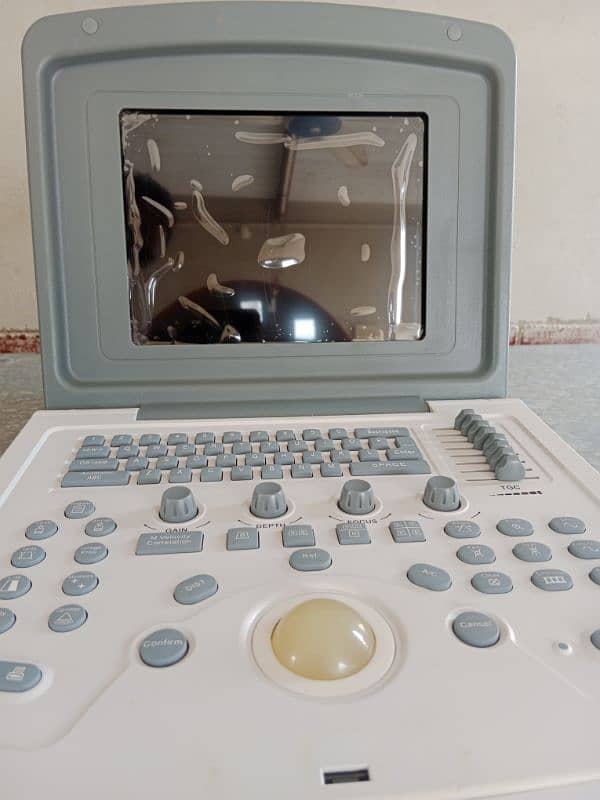 Ultrasound Machine Biocare BU907 0