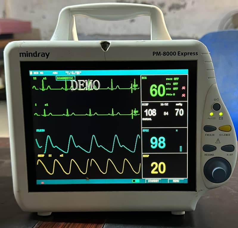 Cardiac monitor 0