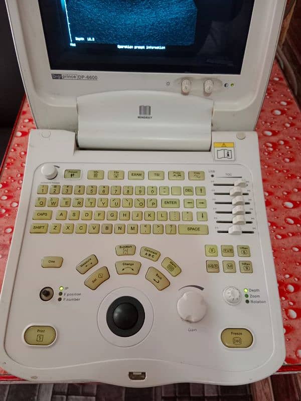 Ultrasound Machine DP-6600 for Sale in Excellent Condition 2