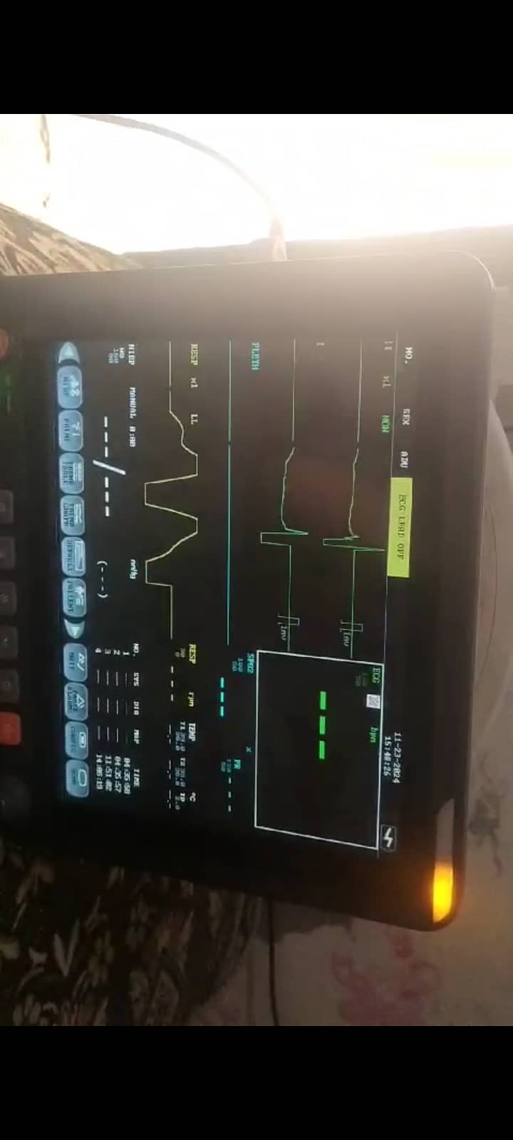 Patient Vitals Monitor 1