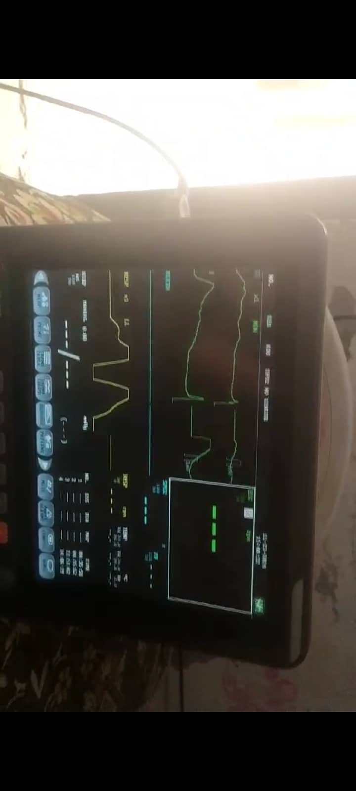 Patient Vitals Monitor 3