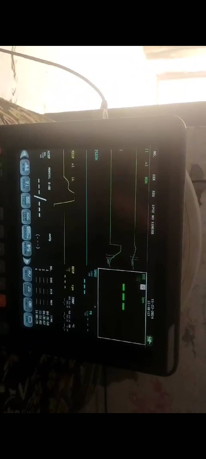 Patient Vitals Monitor 4