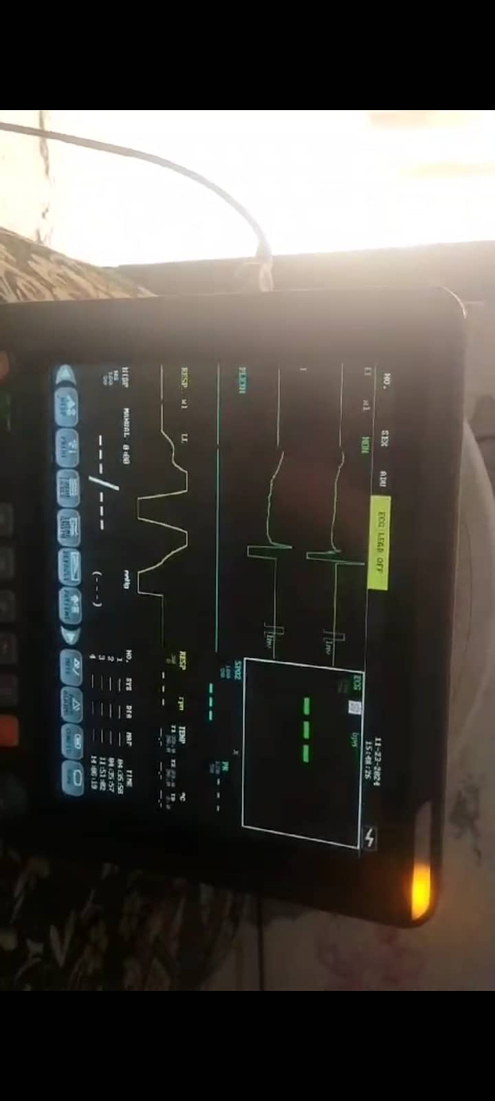 Patient Vitals Monitor 7