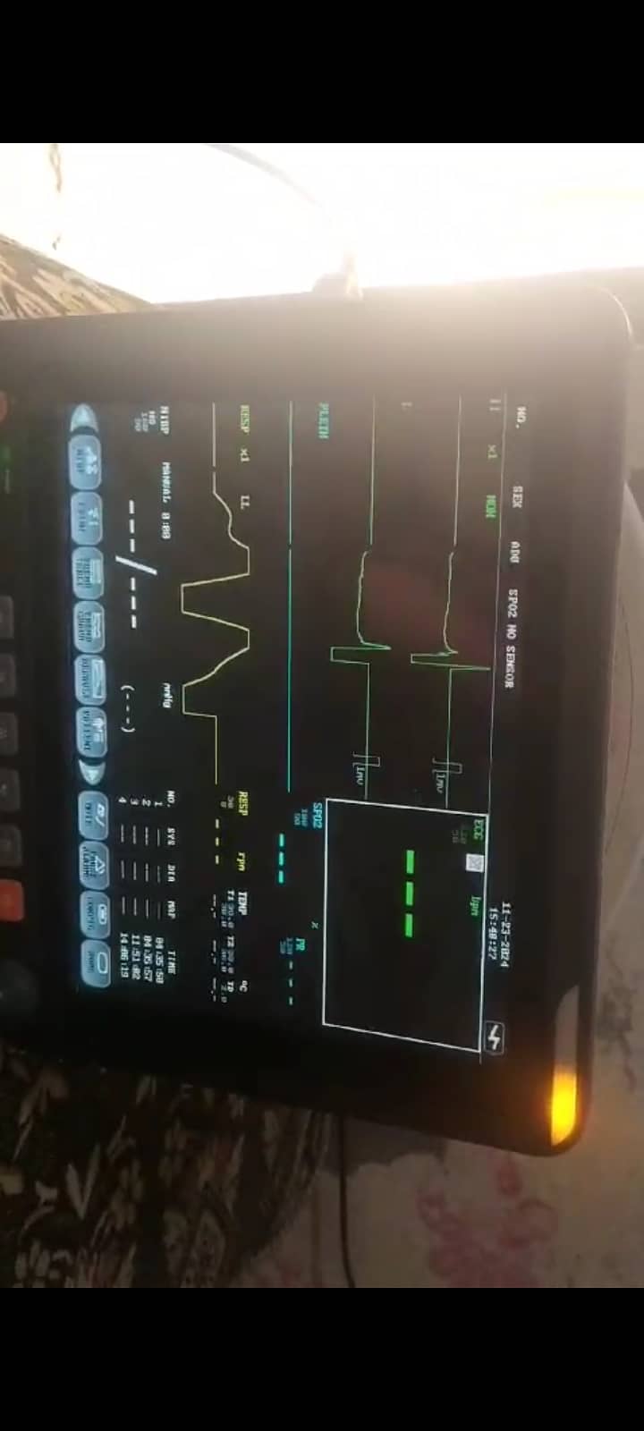 Patient Vitals Monitor 9