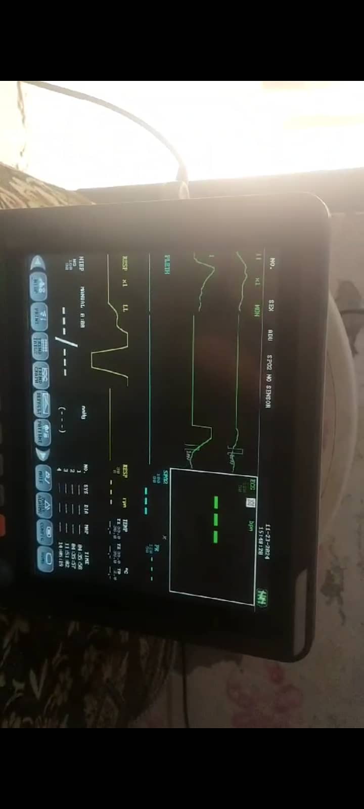 Patient Vitals Monitor 10