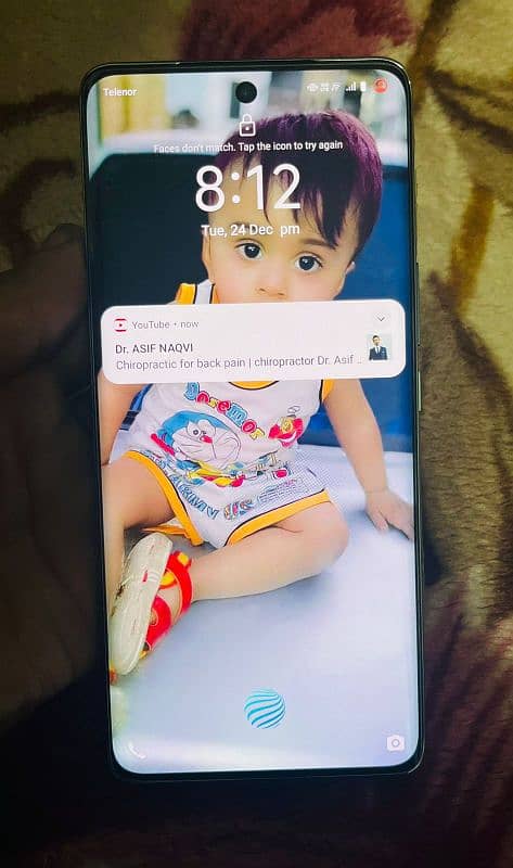 vivo v40e 8.256 6