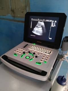 china ultrasound machine