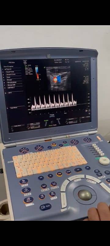 GE-VOLUSEN-E portable color doppler 2