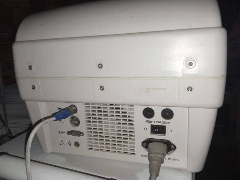 ultrasound Machine ND printer Good newly Condition 4