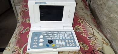 Ultrasound Machine with other gyne instruments