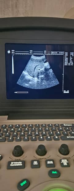 Ultrasound