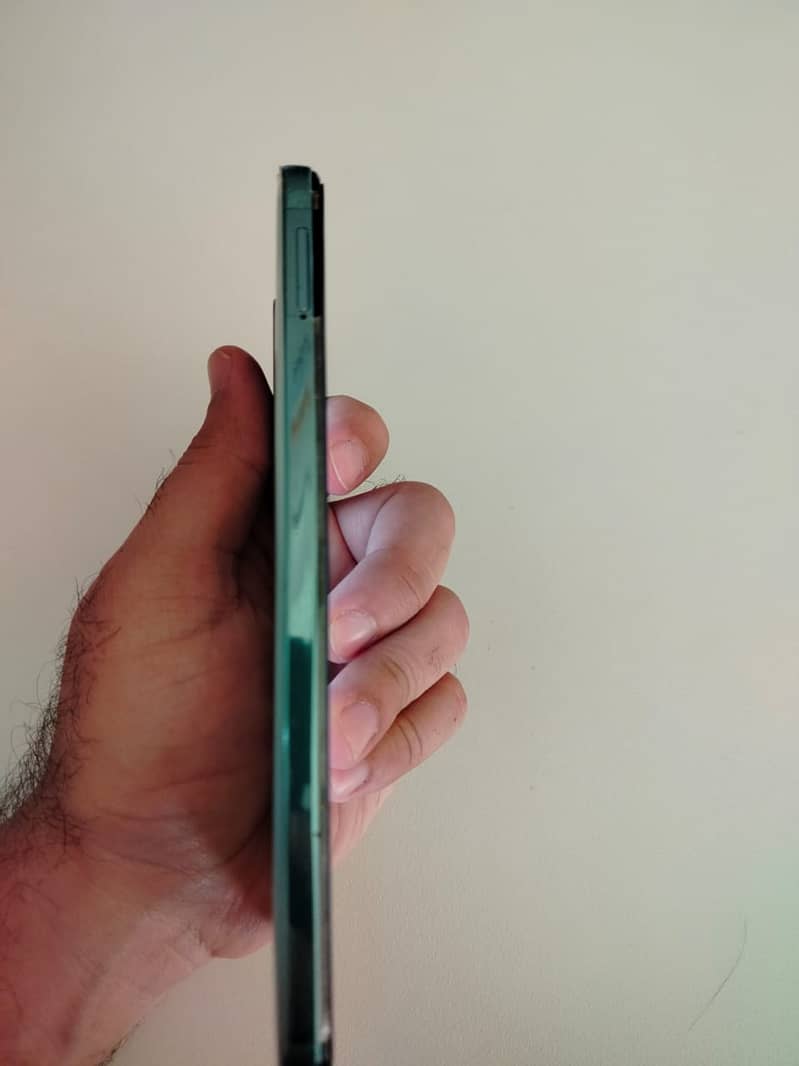 Xiaomi Redmi Note 11 4