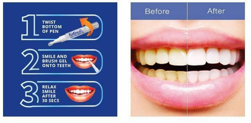 workist teeth whitening pen 1