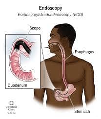 C Arm, Laproscopy Tower, Endoscopy, Digital Xray, OT Setup, ICU, NICU 10