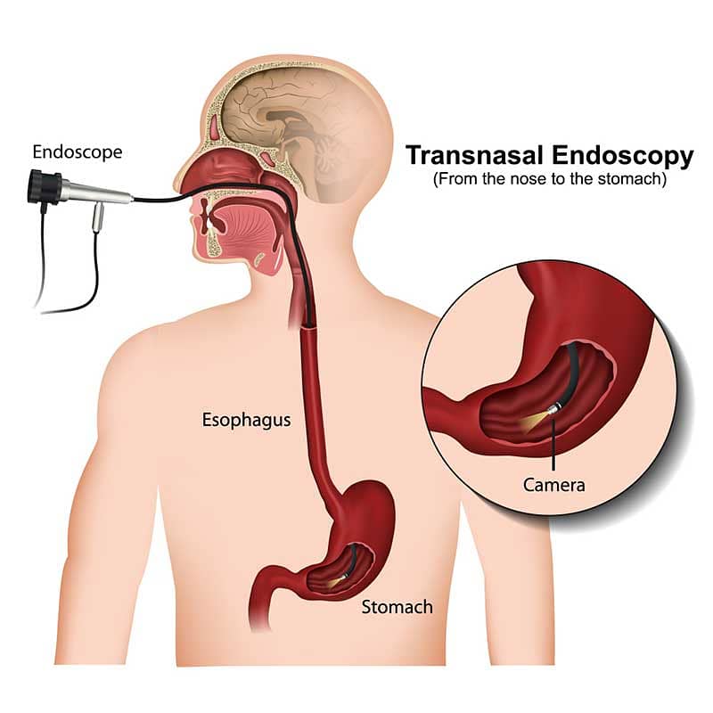 C Arm, Laproscopy Tower, Endoscopy, Digital Xray, OT Setup, ICU, NICU 11