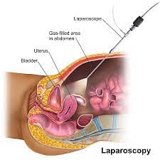 C Arm, Laproscopy Tower, Endoscopy, Digital Xray, OT Setup, ICU, NICU 13