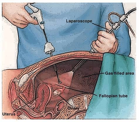 C Arm, Laproscopy Tower, Endoscopy, Digital Xray, OT Setup, ICU, NICU 14