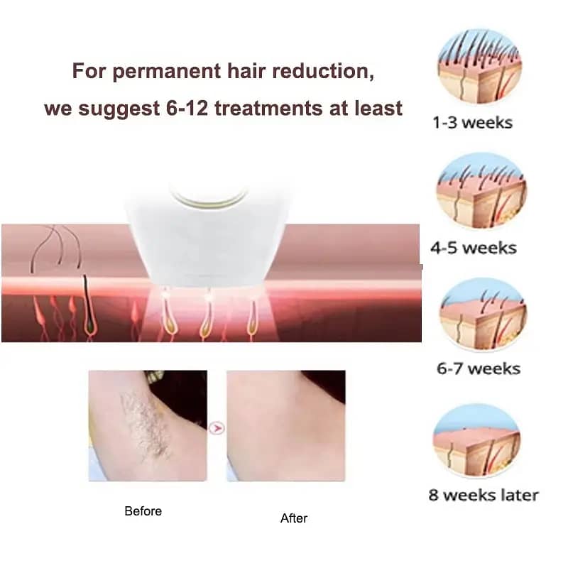 IPL Permanent Laser Hair Remover with 5 Energy Level 500,000 Flashes 6