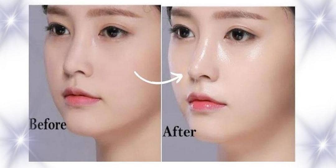 Korean glass skin serum 1