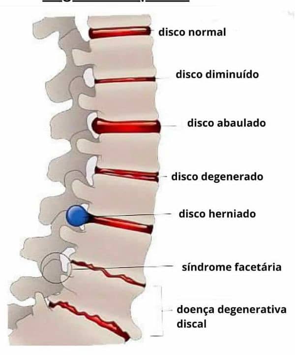 Physiotherapy at your home. 4