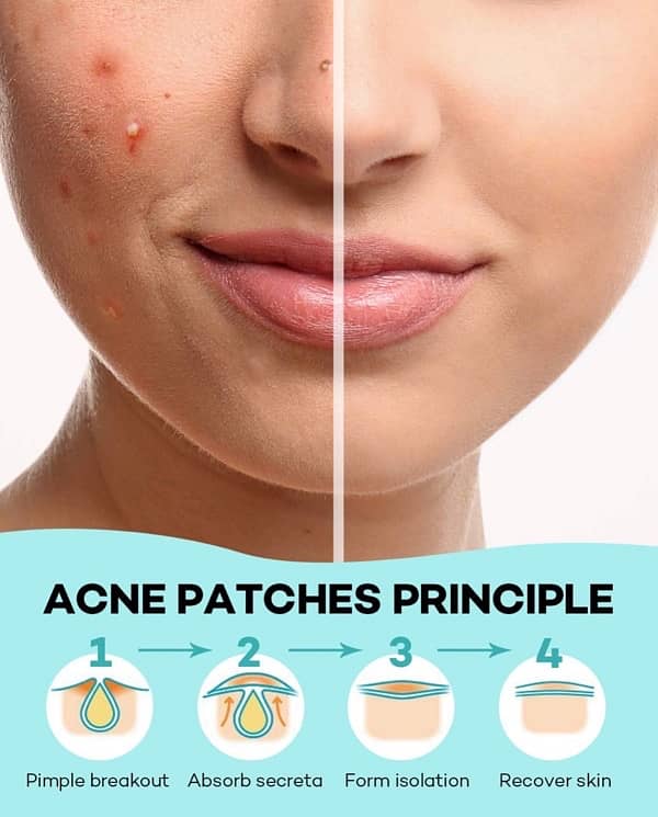 Acne Pimple Patches original USA import (36 Count) 4