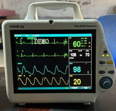 Cardiac monitor