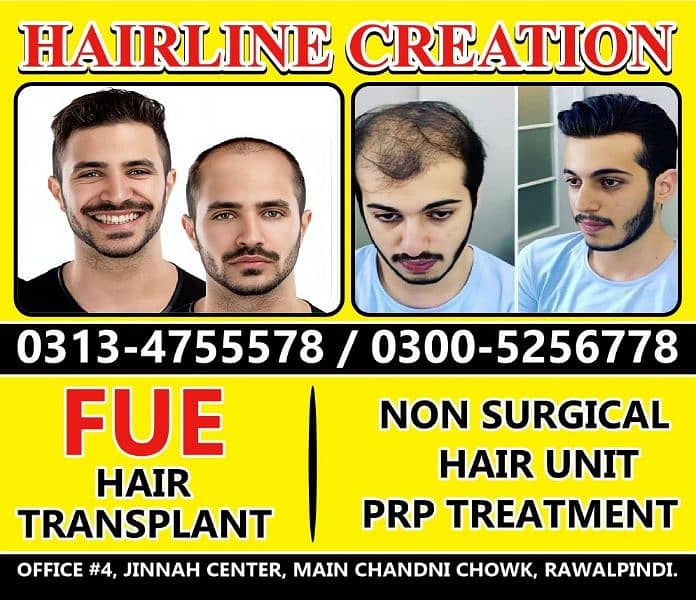 FUE Hair Transplant Hair units 0