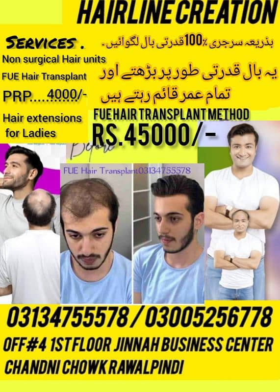 Hair transplant hair unit PRP 0