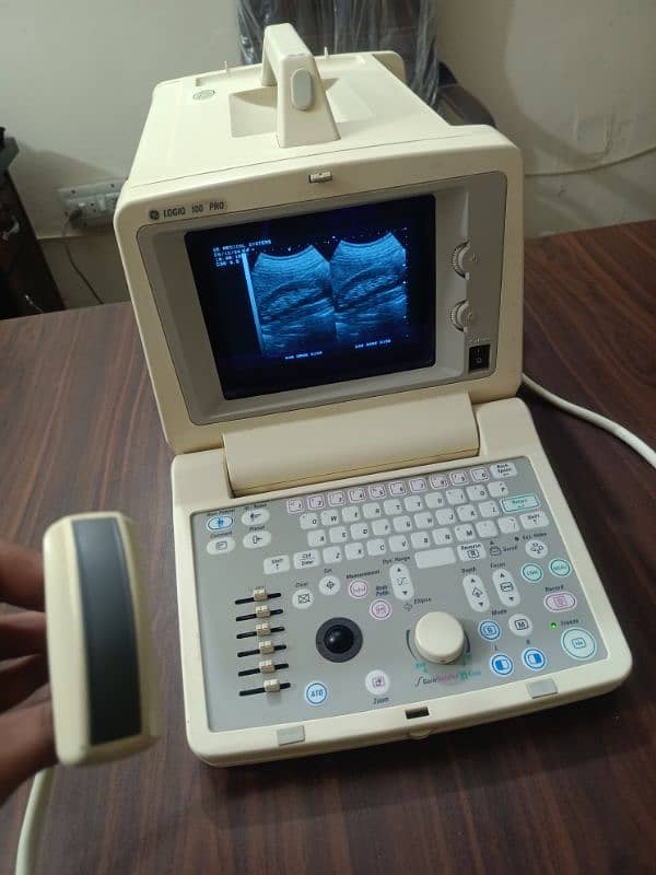 Japanese & China Ultrasound machine's 4