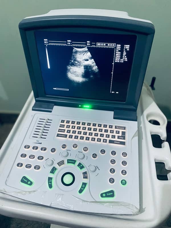 Ultrasound Machine Novadex N9 0