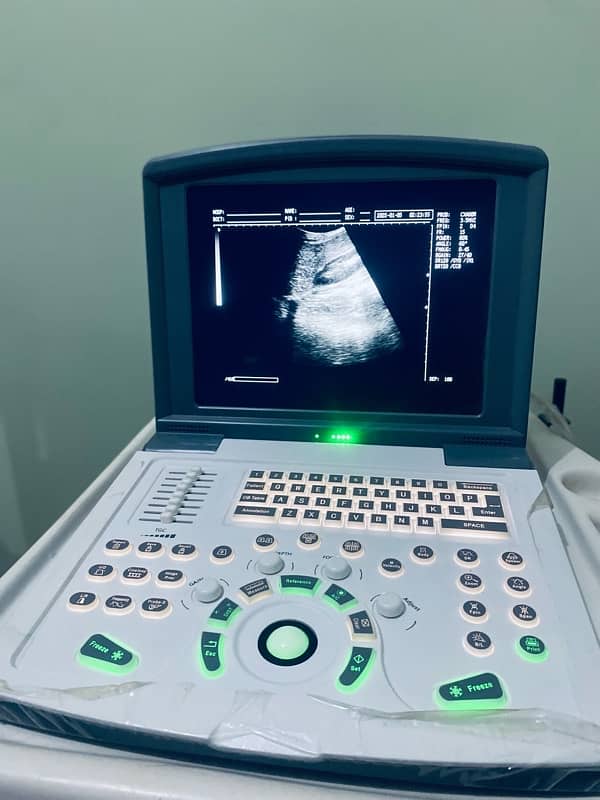 Ultrasound Machine Novadex N9 2