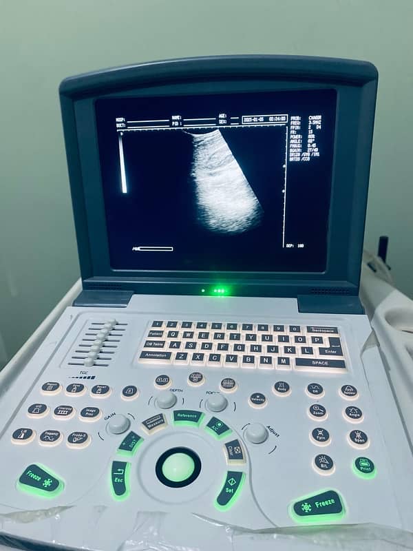 Ultrasound Machine Novadex N9 12