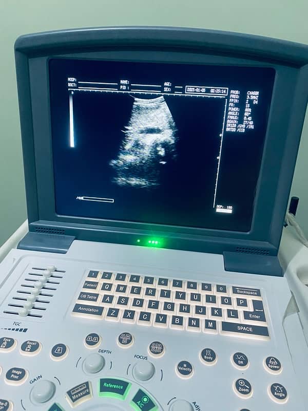 Ultrasound Machine Novadex N9 19