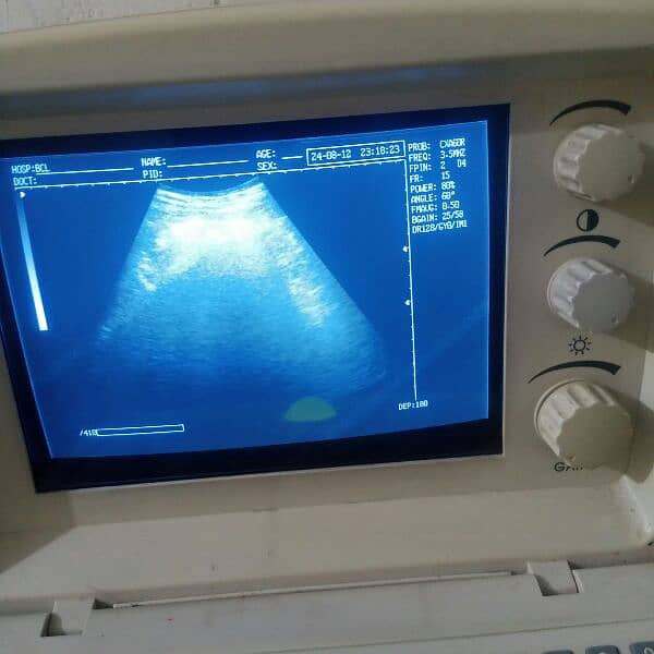 ultrasound machine with printer and trolley for sale 1