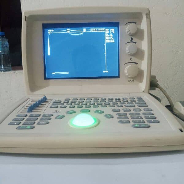 ultrasound machine with printer and trolley for sale 5