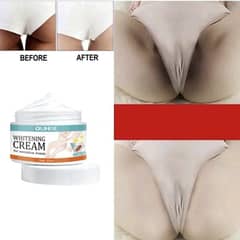 whiting cream for private part