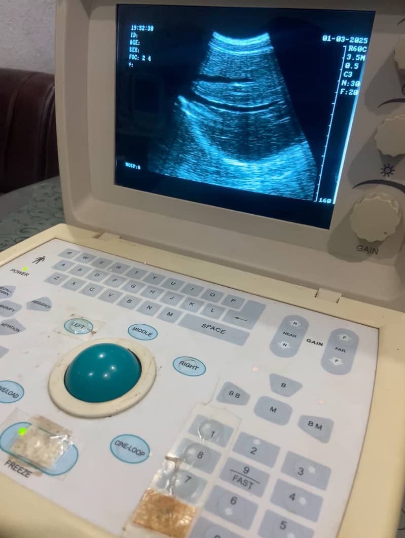 china Ultrasound 0