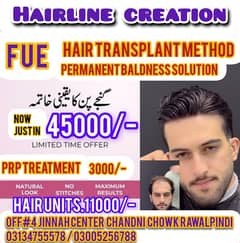 hair system hair transplant services