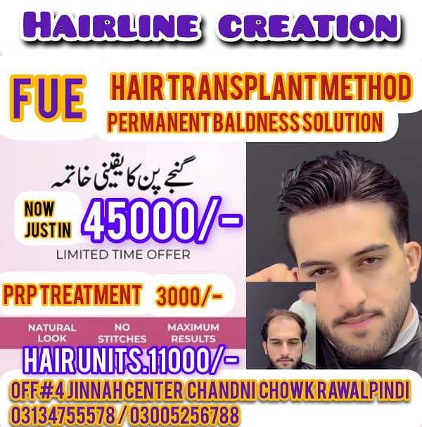 hair system hair transplant services 0